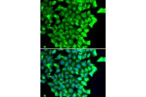Immunofluorescence analysis of MCF-7 cells using TRIAP1 antibody (ABIN4905489). (TRIAP1 anticorps)