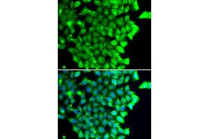 Immunofluorescence analysis of MCF-7 cells using TRIAP1 antibody (ABIN4905489). (TRIAP1 anticorps)