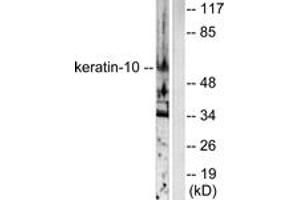 Western blot analysis of extracts from HeLa cells, using Keratin 10 Antibody. (Keratin 10 anticorps  (AA 136-185))