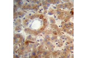 PTEN antibody immunohistochemistry analysis in formalin fixed and paraffin embedded human liver tissue.