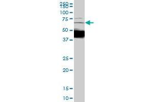 DCP1A monoclonal antibody (M01), clone 2D12. (DCP1A anticorps  (AA 186-285))