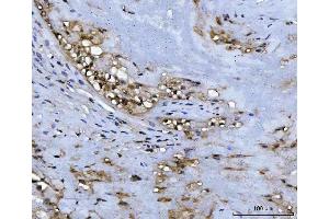 IHC analysis of ADK using anti-ADK antibody (ABIN4886430). (ADK anticorps  (AA 165-351))