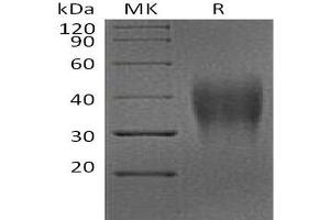 Western Blotting (WB) image for V-type immunoglobulin domain-containing suppressor of T-cell activation (VISTA) protein (His tag) (ABIN7320948)