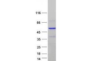 Validation with Western Blot