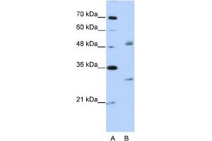 WB Suggested Anti-WBSCR1 Antibody Titration:  2. (EIF4H anticorps  (Middle Region))