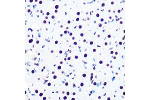 Immunohistochemistry of paraffin-embedded rat ovary using DDX5 Rabbit mAb (ABIN7266698) at dilution of 1:100 (40x lens). (DDX5 anticorps)
