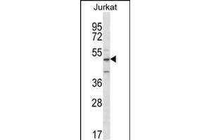 ABI2 Antibody (N-term)  western blot analysis in Jurkat cell line lysates (35 μg/lane). (ABI2 anticorps  (N-Term))