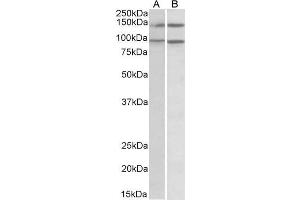 ABIN185123 (0. (ARHGEF18 anticorps  (C-Term))