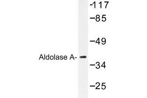Image no. 1 for anti-Aldolase A, Fructose-Bisphosphate (ALDOA) antibody (ABIN272155) (ALDOA anticorps)