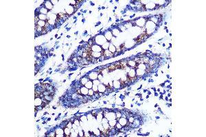 Immunohistochemistry of paraffin-embedded human colon using Monoamine Oxidase B (MAOB) (MAOB) Rabbit mAb (ABIN7268682) at dilution of 1:100 (40x lens). (Monoamine Oxidase B anticorps)