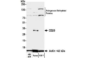 Western Blotting (WB) image for anti-Biotin antibody (ABIN7795748) (Recombinant Biotin anticorps)