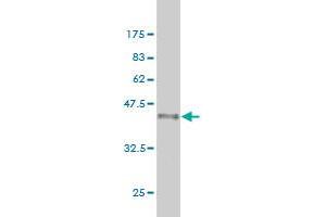 Western Blot detection against Immunogen (36. (Exportin 2 anticorps  (AA 872-971))