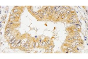 Immunohistochemistry (IHC) image for anti-Growth Factor Receptor-Bound Protein 10 (GRB10) (AA 100-150) antibody (ABIN7454420)