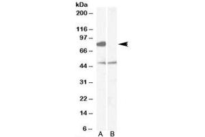 Western blot testing of human brain [frontal cortex] lysate with [B] and without [A] immunizing peptide using ZDHHC8 antibody at 0.