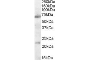 Image no. 1 for anti-Cholinergic Receptor, Nicotinic, alpha 4 (CHRNA4) (AA 29-43), (Internal Region) antibody (ABIN375184) (CHRNA4 anticorps  (Internal Region))
