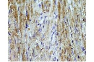 Mouse heart tissue was stained by Angiotensin II (1-7) Antiserum at 1:100 (AGT anticorps  (AA 1-7))