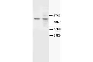 Western Blotting (WB) image for anti-BRCA1 Associated Protein-1 (Ubiquitin Carboxy-terminal Hydrolase) (BAP1) antibody (ABIN1105494) (BAP1 anticorps)