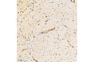 Immunohistochemistry analysis of paraffin embedded mouse heart using ACTN1 (ABIN7072905) at dilution of 1: 300 (ACTN1 anticorps)