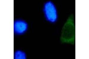 Immunofluorescence (IF) image for anti-Human Papilloma Virus Type 18 (HPV-18) (AA 1-83), (N-Term) antibody (ABIN781773) (HPV18 anticorps  (N-Term))