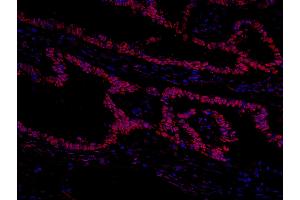 Immunofluorescence (IF) image for anti-General Transcription Factor III (GTF2I) (AA 985-998) antibody (ABIN7448971)