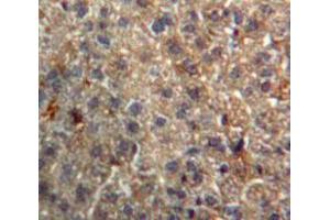 Used in DAB staining on fromalin fixed paraffin-embedded Liver tissue (Importin 8 anticorps  (AA 417-622))