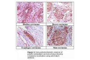 Image no. 1 for anti-RAB25, Member RAS Oncogene Family (RAB25) antibody (ABIN207613) (RAB25 anticorps)
