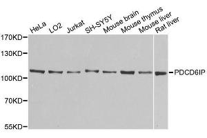 Western blot analysis of extracts of various cell lines, using PDCD6IP antibody. (ALIX anticorps  (AA 1-180))