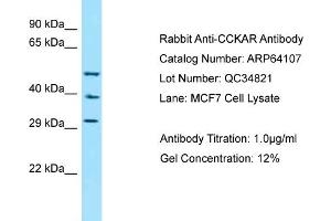 Western Blotting (WB) image for anti-Cholecystokinin A Receptor (CCKAR) (N-Term) antibody (ABIN2789734) (CCKAR anticorps  (N-Term))