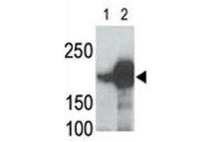LRP5 antibody used in western blot to detect recombinant human LRP5 (Lane 1) and mouse LRP5 (2) proteins in transfected 293 cell lysate (LRP5 anticorps  (AA 1538-1567))