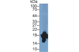 Detection of SOD1 in Rabbit Liver lysate using Polyclonal Antibody to Superoxide Dismutase 1 (SOD1)