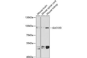 Western blot analysis of extracts of various cell lines, using GUCY2D antibody (ABIN1680144, ABIN3017868, ABIN3017870 and ABIN6220291) at 1:1000 dilution. (GUCY2D anticorps  (AA 52-350))