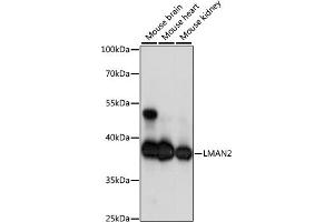 Western blot analysis of extracts of various cell lines, using LM antibody (ABIN7268203) at 1:1000 dilution. (LMAN2 anticorps  (AA 190-320))