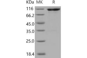 Western Blotting (WB) image for Vascular Cell Adhesion Molecule 1 (VCAM1) (Active) protein (His tag,Fc Tag) (ABIN7198677)