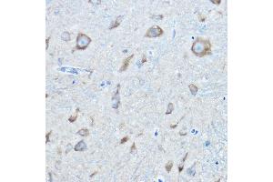 Immunohistochemistry of paraffin-embedded mouse spinal cord using SARS Rabbit pAb (ABIN6127528, ABIN6147383, ABIN6147385 and ABIN6217311) at dilution of 1:100 (40x lens).