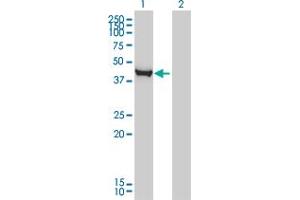 Western Blot analysis of CTH expression in transfected 293T cell line by CTH monoclonal antibody (M03), clone S51. (CTH anticorps  (AA 1-405))