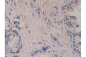 Detection of BCAS3 in Human Prostate Tissue using Polyclonal Antibody to Breast Carcinoma Amplified Sequence 3 (BCAS3)