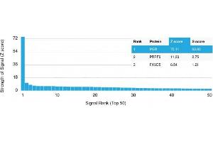 Analysis of Protein Array containing more than 19,000 full-length human proteins using Progesterone Receptor Mouse Monoclonal Antibody (PGR/2694).