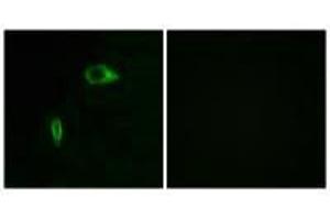 Immunofluorescence analysis of HeLa cells, using Collagen XIV α1 antibody. (COL14A1 anticorps)
