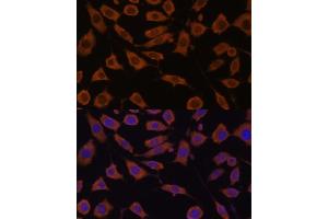 Immunofluorescence analysis of L929 cells using STUB1 Polyclonal Antibody (ABIN6129459, ABIN6148649, ABIN6148650 and ABIN6215447) at dilution of 1:100 (40x lens). (STUB1 anticorps  (AA 1-303))