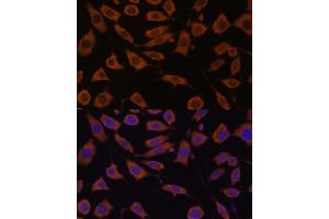 Immunofluorescence analysis of L929 cells using STUB1 Polyclonal Antibody (ABIN6129459, ABIN6148649, ABIN6148650 and ABIN6215447) at dilution of 1:100 (40x lens). (STUB1 anticorps  (AA 1-303))