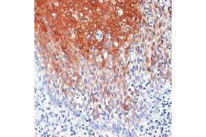 Immunohistochemistry of paraffin-embedded human tonsil using S100 antibody (ABIN7270129) at dilution of 1:200 (40x lens). (S100A8 anticorps  (AA 1-93))