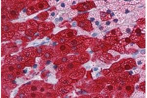 Human Adrenal: Formalin-Fixed, Paraffin-Embedded (FFPE)