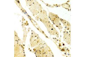 Immunohistochemistry of paraffin-embedded Human esophageal using PRKAA1 antibody at dilution of 1:100 (x400 lens).