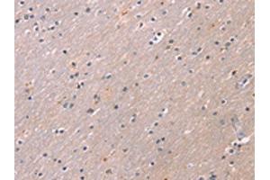The image on the left is immunohistochemistry of paraffin-embedded Human brain tissue using ABIN7191189(KCNK3 Antibody) at dilution 1/20, on the right is treated with synthetic peptide. (KCNK3 anticorps)