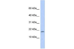 WB Suggested Anti-RPS15 Antibody Titration: 0. (RPS15 anticorps  (Middle Region))