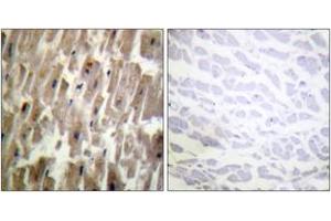 Immunohistochemistry analysis of paraffin-embedded human heart, using CRYAB (Phospho-Ser45) Antibody.