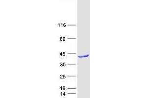 Validation with Western Blot (Acad8 Protein (Myc-DYKDDDDK Tag))
