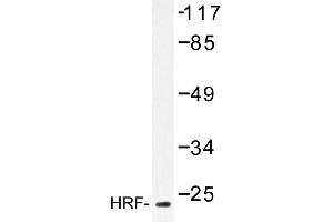 Image no. 1 for anti-Tumor Protein, Translationally-Controlled 1 (TPT1) antibody (ABIN272165) (TPT1 anticorps)