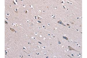 The image on the left is immunohistochemistry of paraffin-embedded Human brain tissue using ABIN7129969(KCNQ5 Antibody) at dilution 1/60, on the right is treated with fusion protein. (KCNQ5 anticorps)