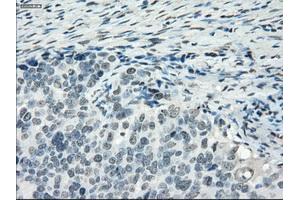 Immunohistochemical staining of paraffin-embedded colon tissue using anti-PDE10A mouse monoclonal antibody. (PDE10A anticorps)
